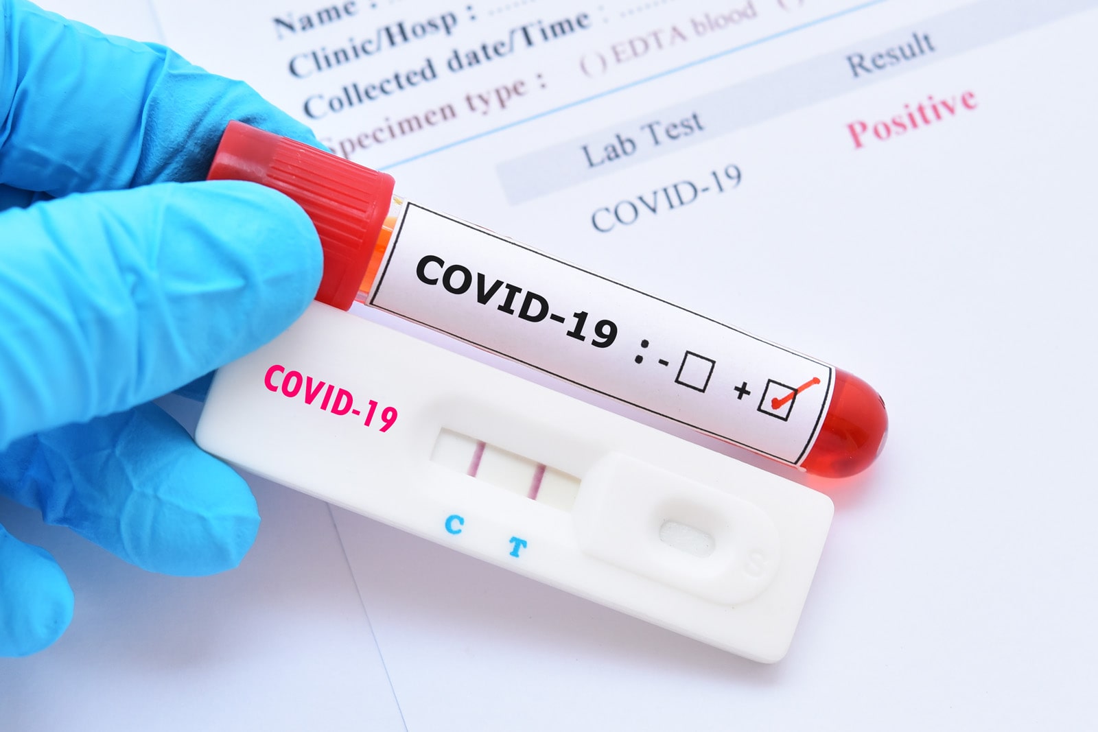 Диагностика COVID-19 в клиниках Баку
